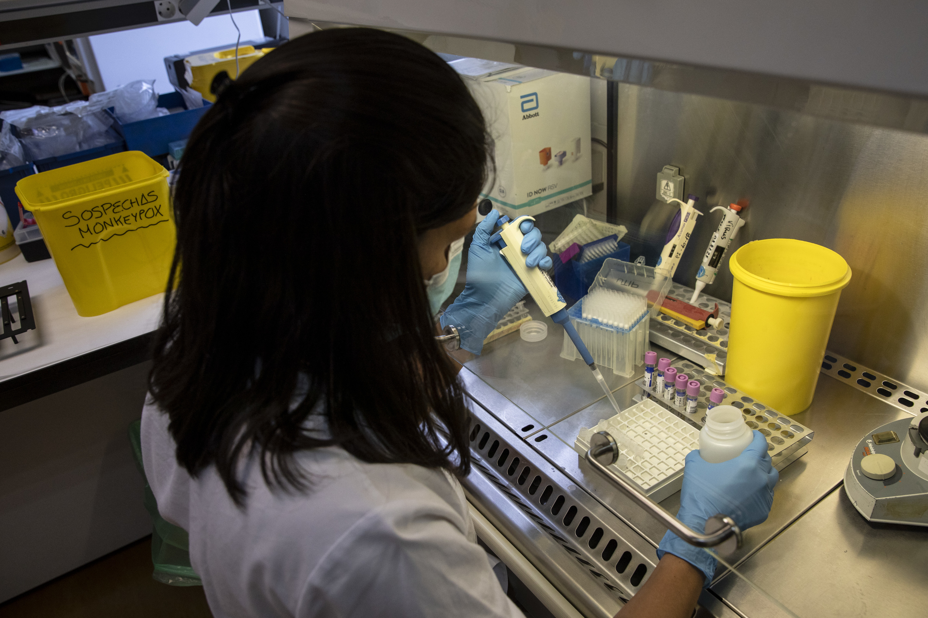 Un técnico de laboratorio analiza muestras de viruela en el Hospital Universitario La Paz