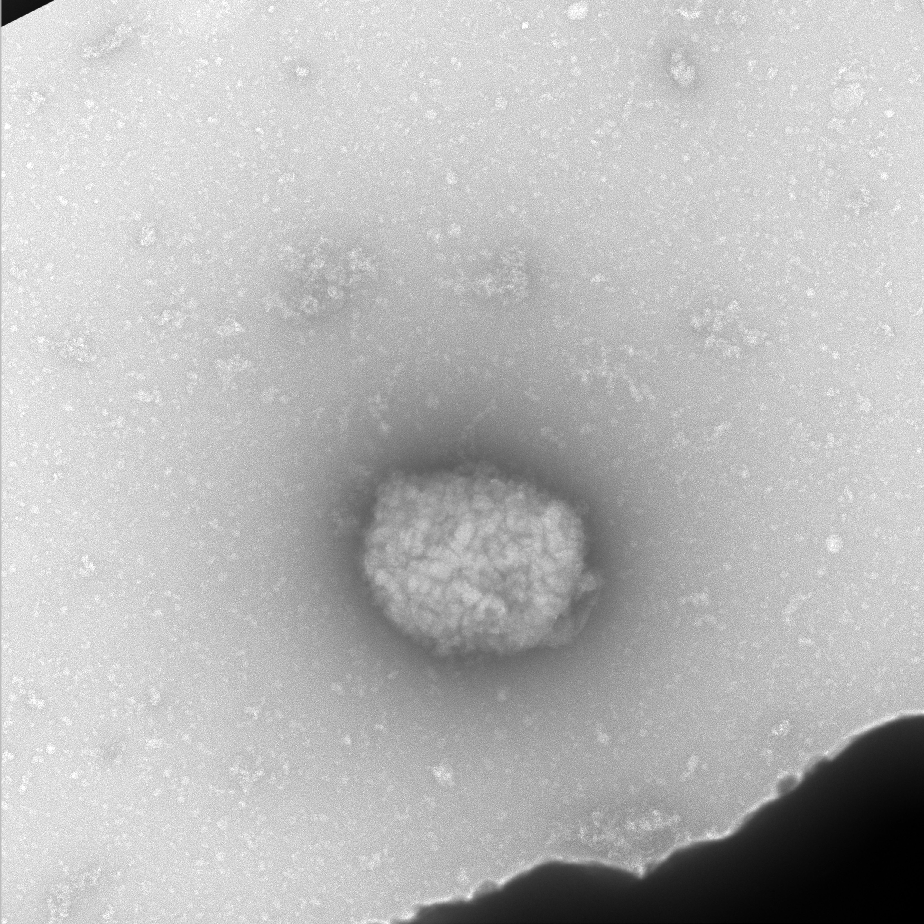 Partículas virales del virus del mono observadas por microscopia electrónica de transmisión directamente del líquido obtenido de pústulas de pacientes infectados.