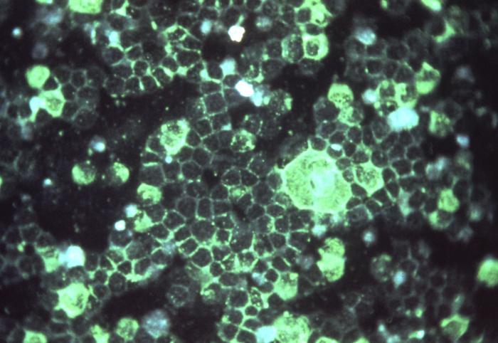 Virus respiratorio sincitial bajo microscopía de inmunofluorescencia.