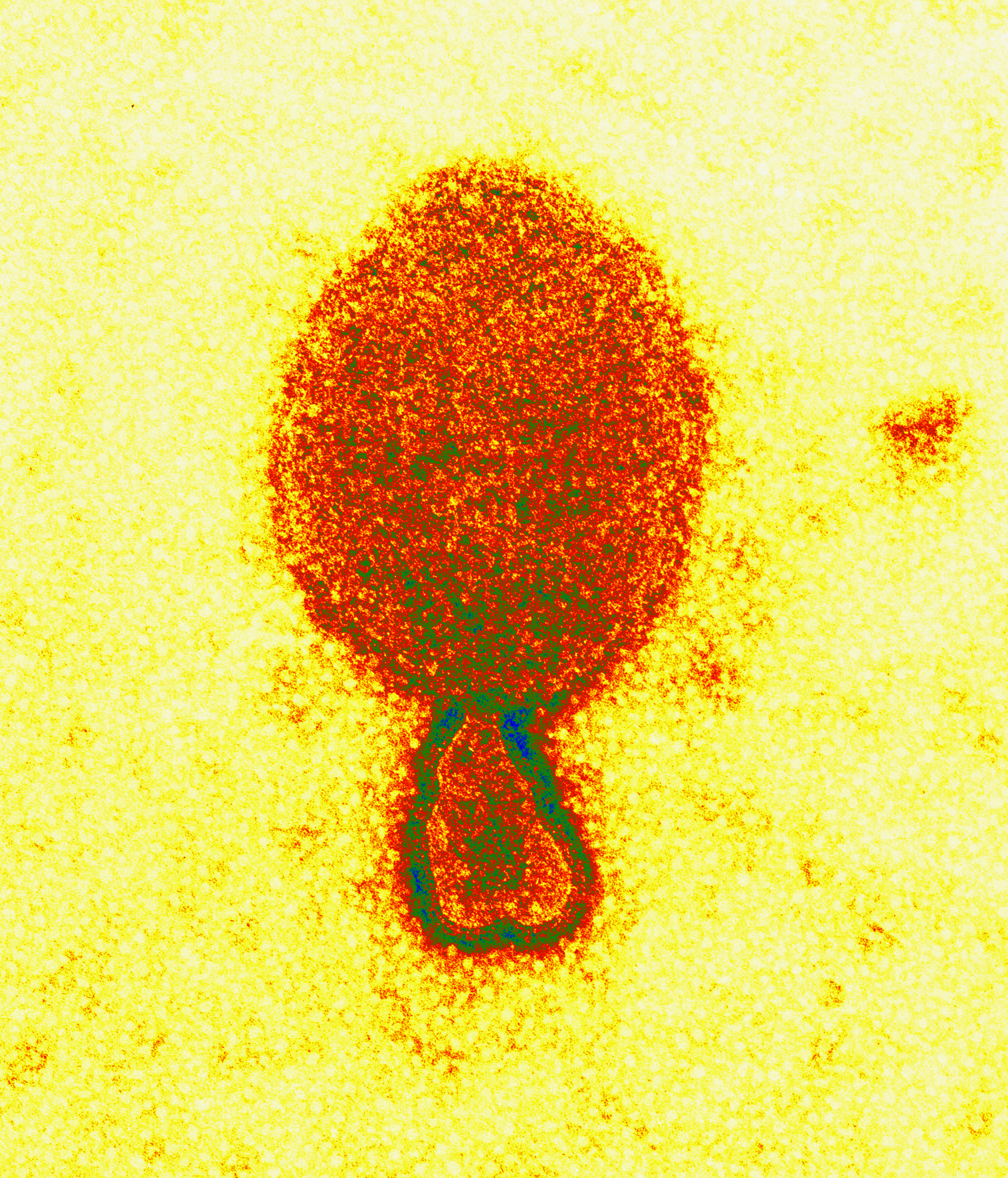 Virus Hendra, una de las especies que conforman el Henipavirus.