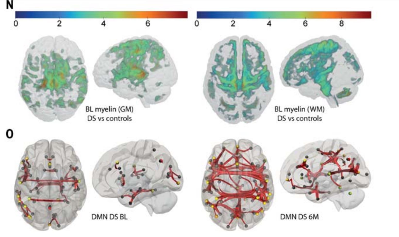 Detalle de los cambios registrados en las conexiones cerebrales.