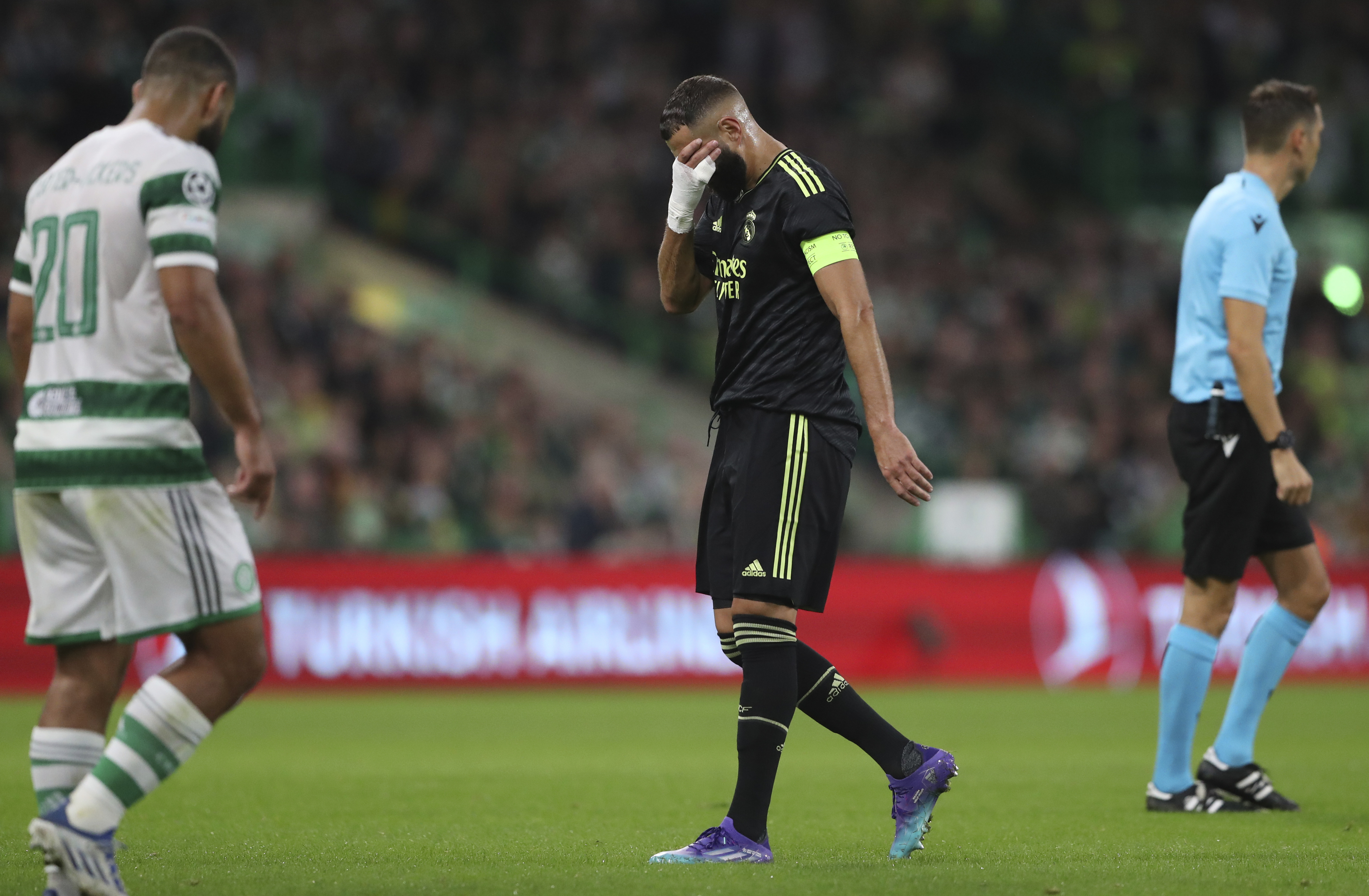 Benzema se tapa la cara tras notar algo en la rodilla durante el choque contra el Celtic.