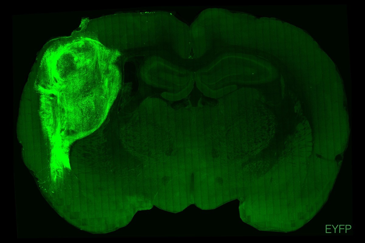 Organoide humano trasplantado en el cerebro de una rata, marcado con protena fluorescente.
