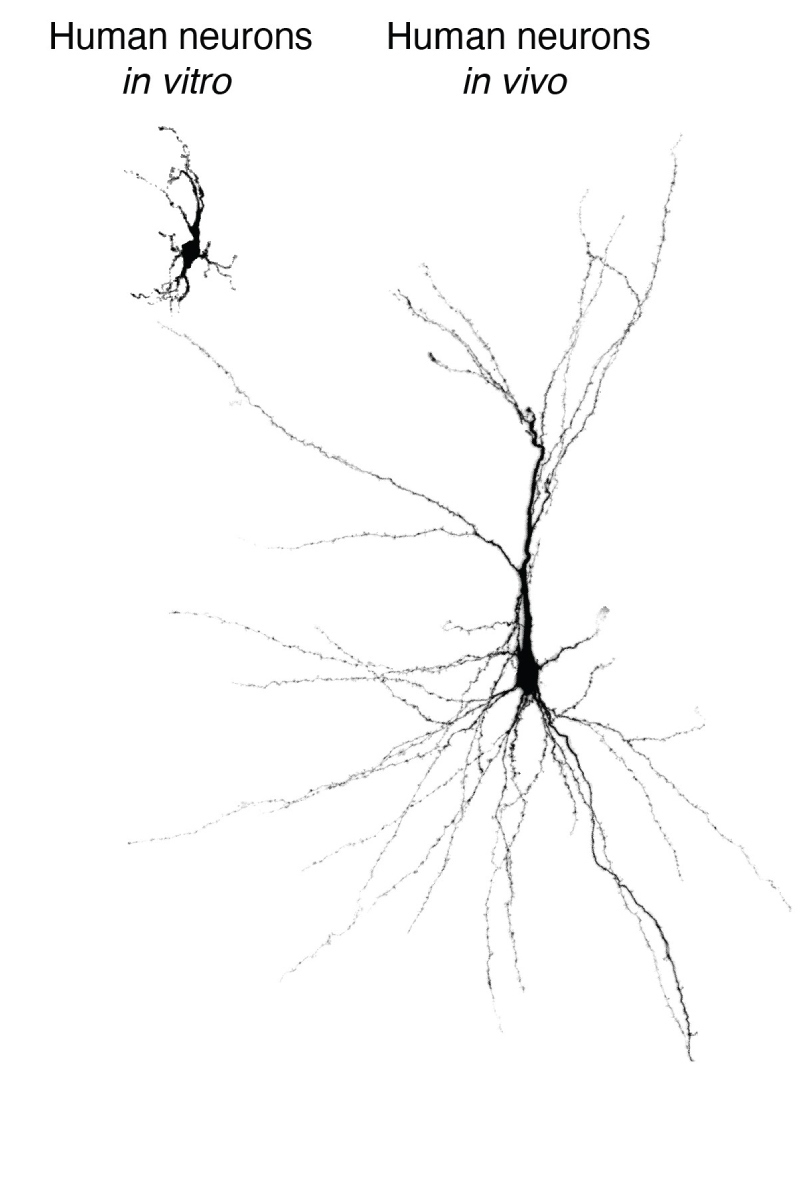 Neuronas humanas derivadas de clulas madre y mantenidas 'in vitro' o trasplantadas en el crtex del cerebro de rata.