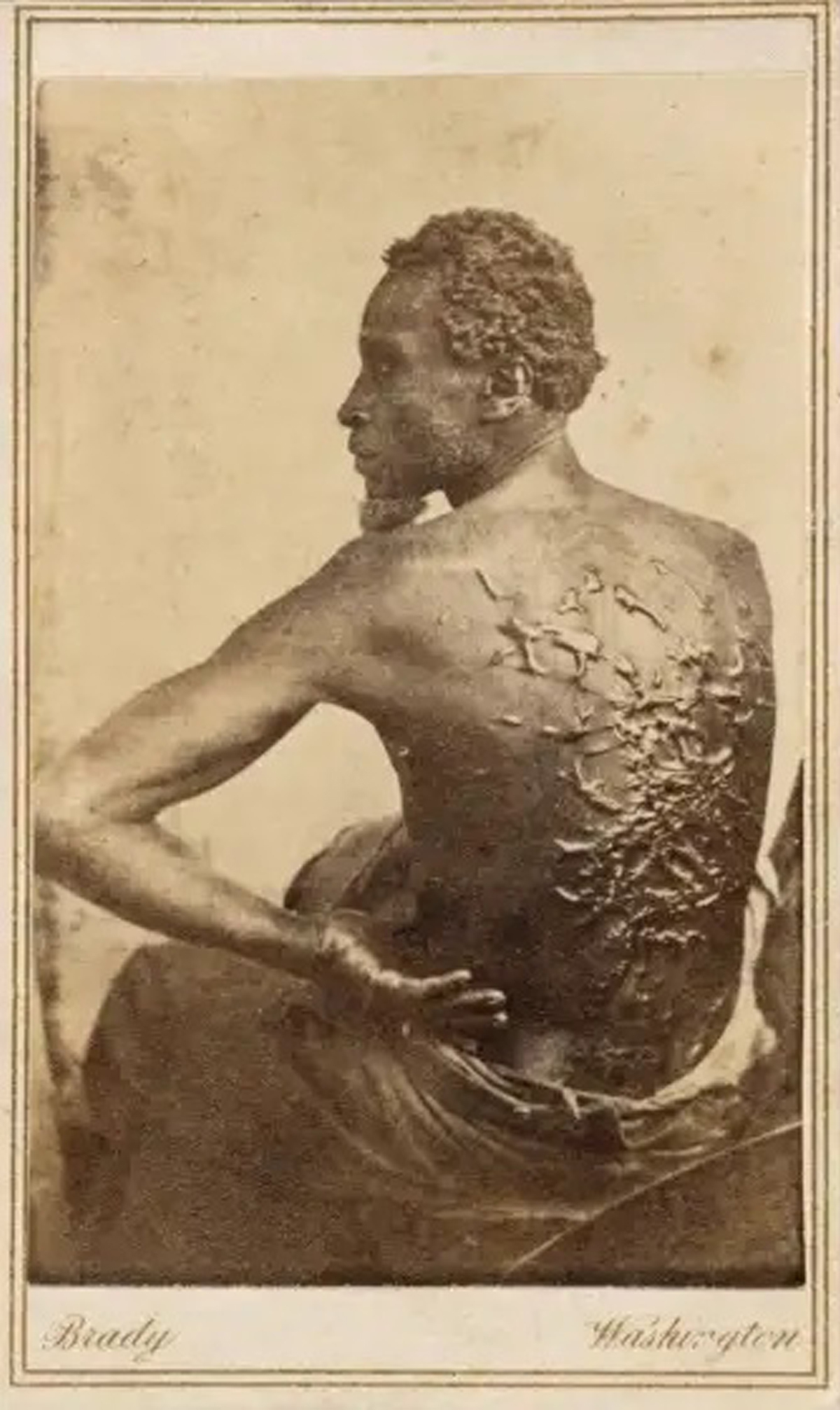Las fotos mostrando las cicatrices en la espalda de Gordon 'Peter Azotado', producto de los latigazos de sus dueños, alentaron a miles de negros libres a alistarse con los unionistas y combatir contra las tropas sureñas.