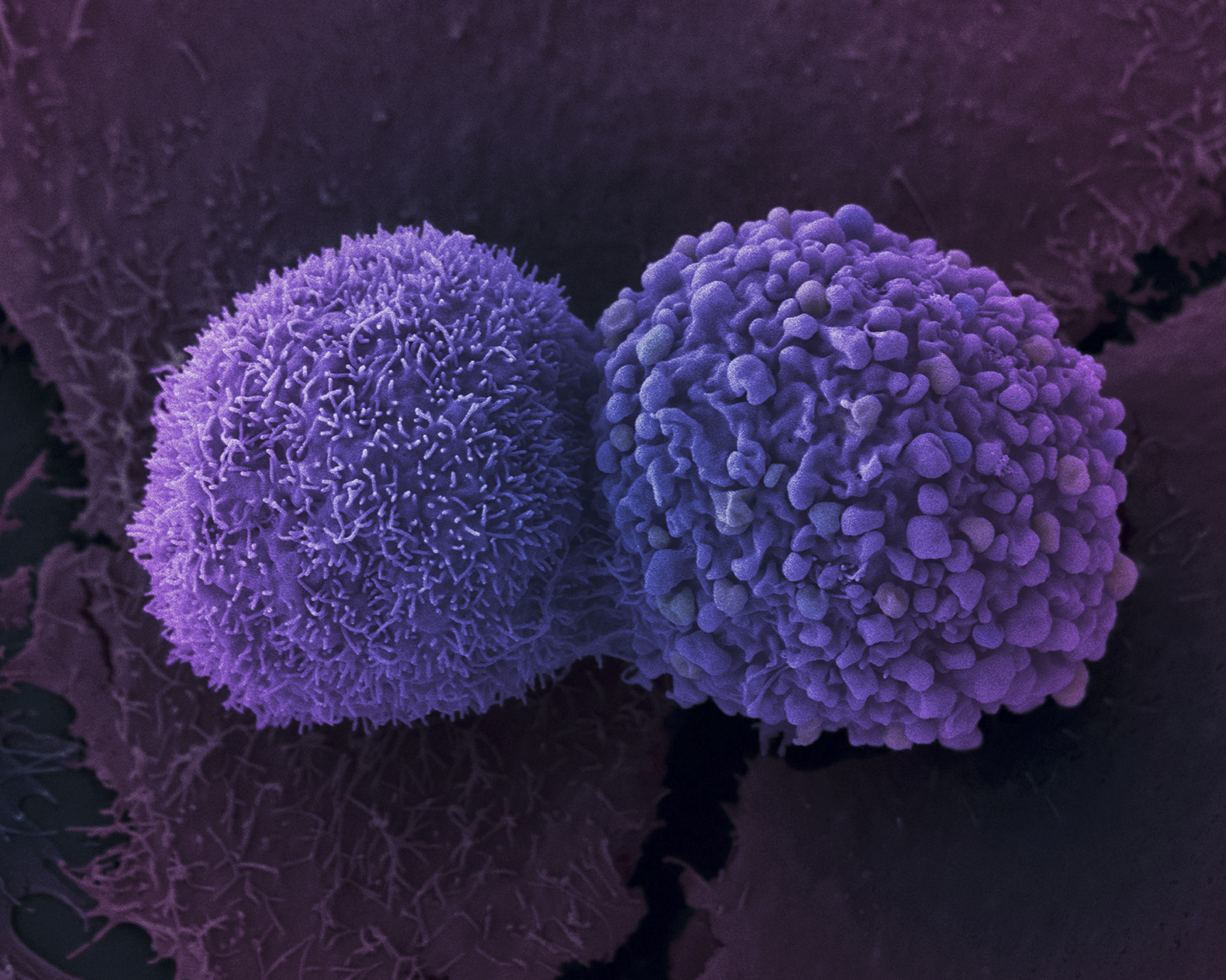Células de cáncer de pulmón, en una imagen del nstituto Francis Crick.
