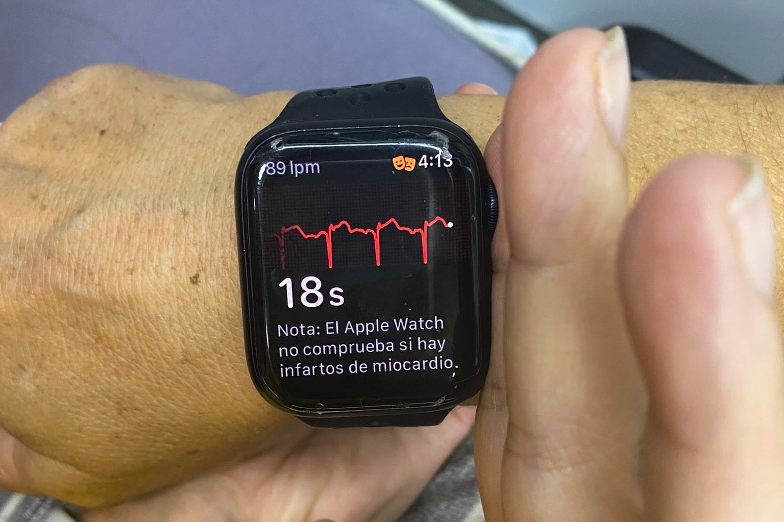 doce Desgastado puerta Una médico española diagnostica un infarto en una emergencia con un Apple  Watch | Gadgets