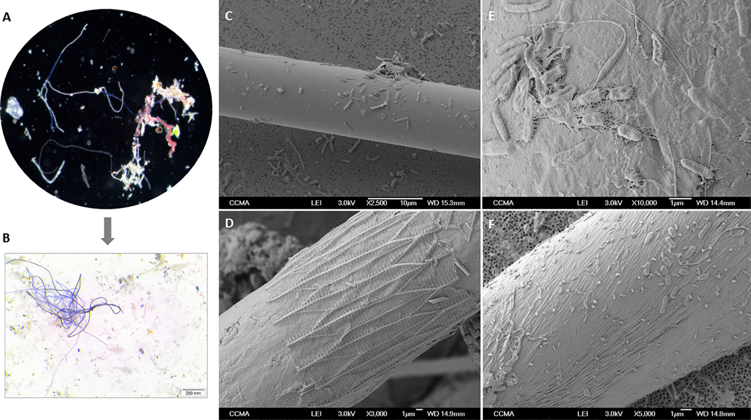 Detalle microscpico de fibras recogidas en noroeste del Mediterrneo