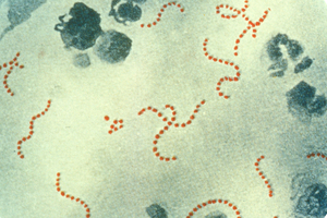 Imagen de la bacteria estreptococo del grupo A.