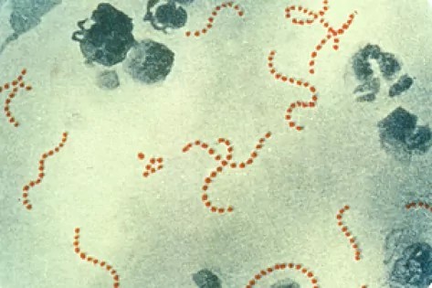 Imagen de la bacteria estreptococo del grupo A.UKHSA.