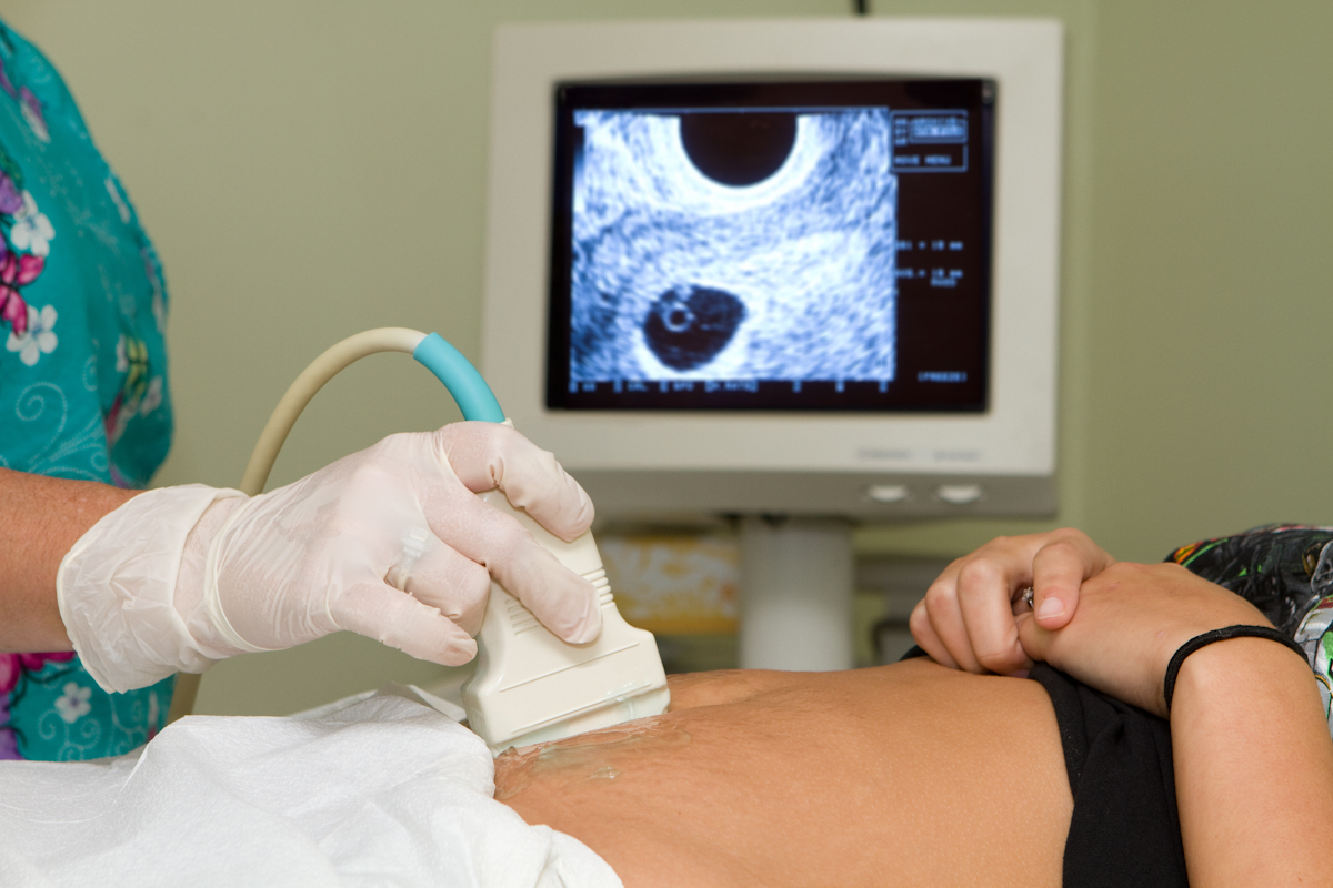 Un sanitario realiza una ecografía para diagnosticar el estado de una embarazada.