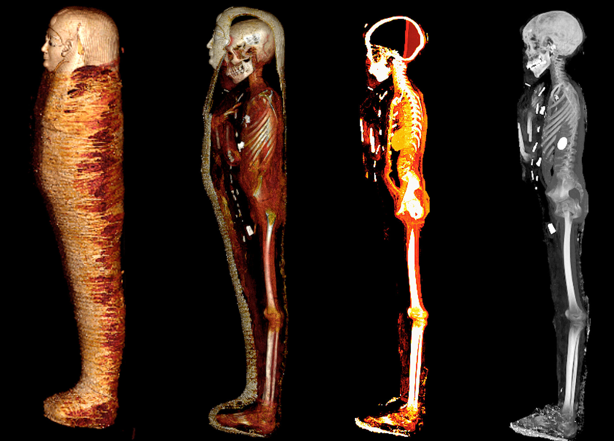 Imágenes obtenidas al pasar la momia por el escáner