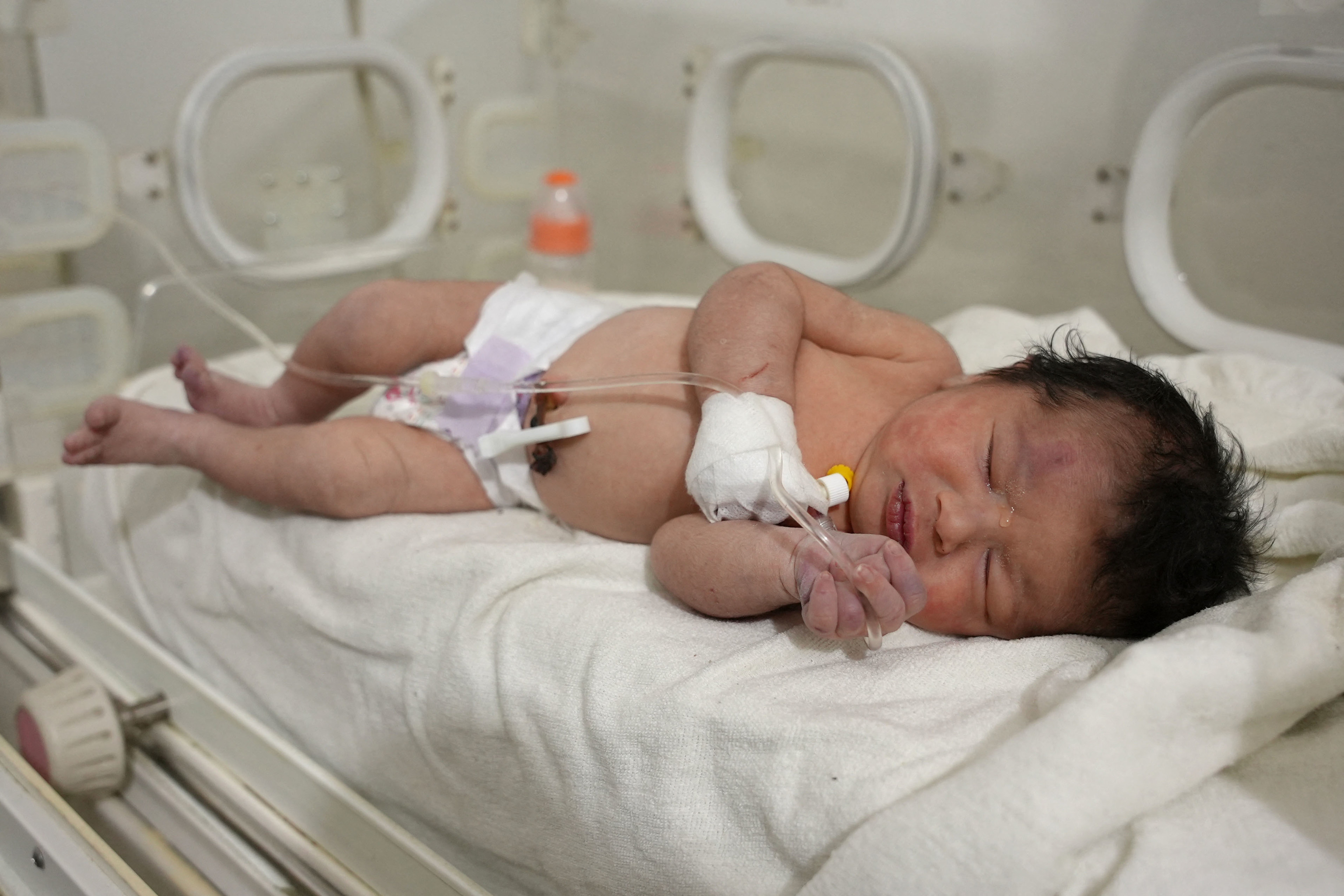 La bebé, ya en un hospital del norte de Siria.