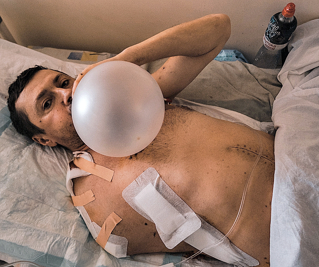 Dmytro, amputado del brazo derecho, se recupera en el hospital Defensa Fronteriza de Kiev.