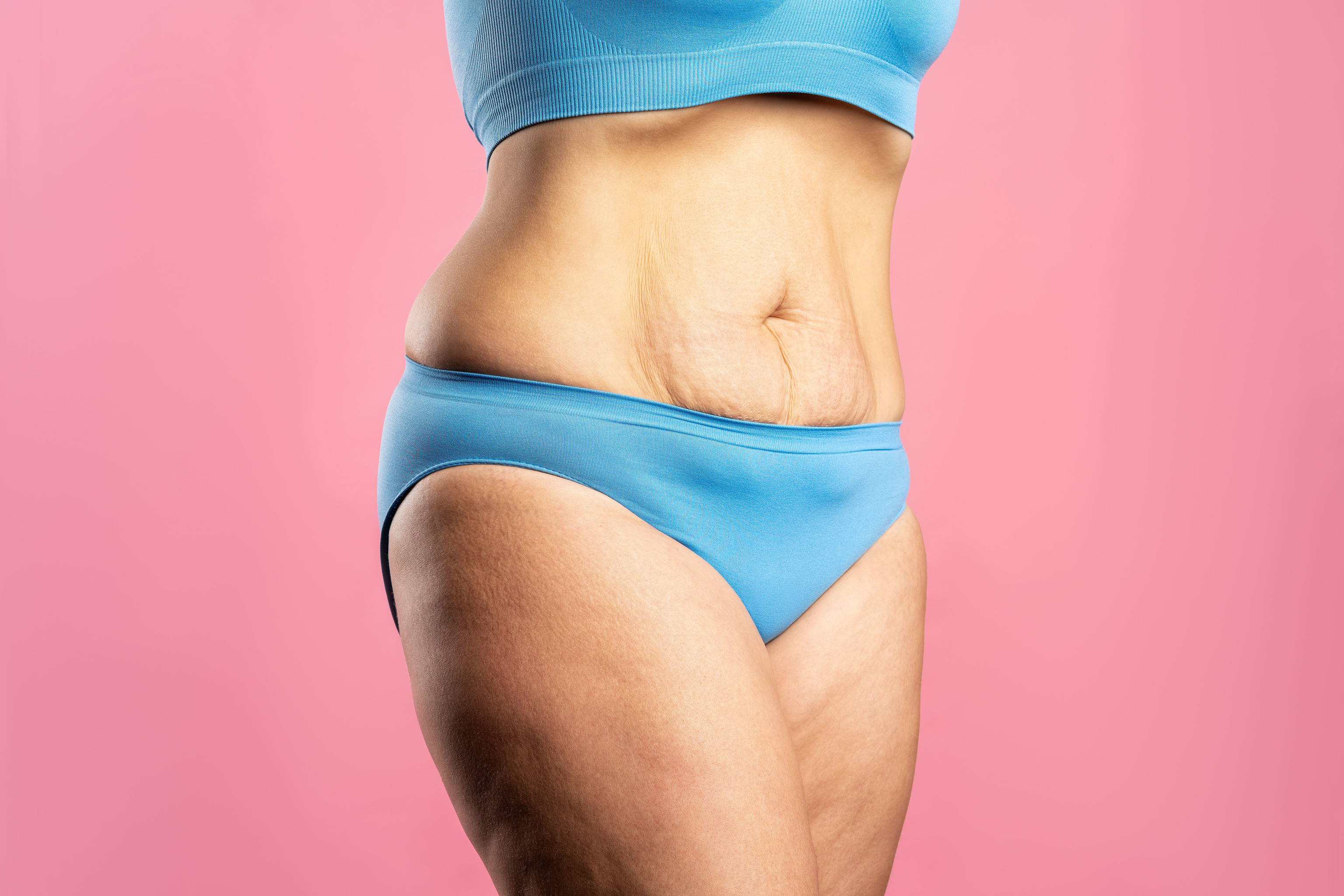 Tipos de barriga y cómo eliminarlas, Cómo perder peso y panza