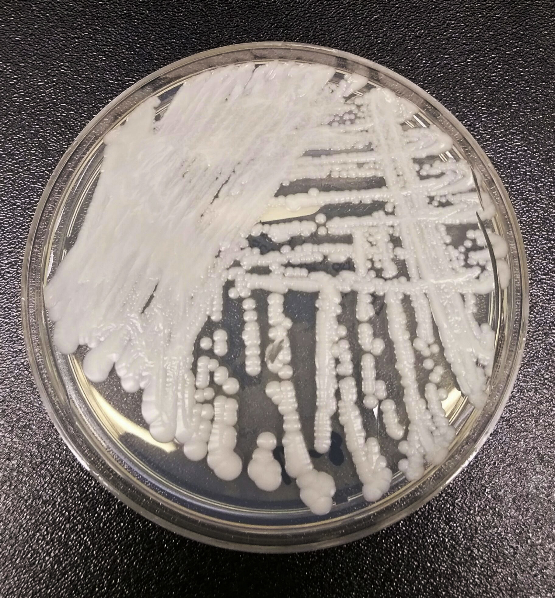 Una cepa de Candida auris cultivada en una placa de petri.