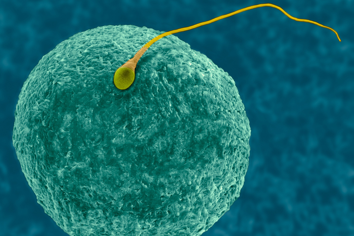 Una micrografía electrónica de barrido en color que muestra un óvulo humano (ovocito) y esperma (espermatozoide).