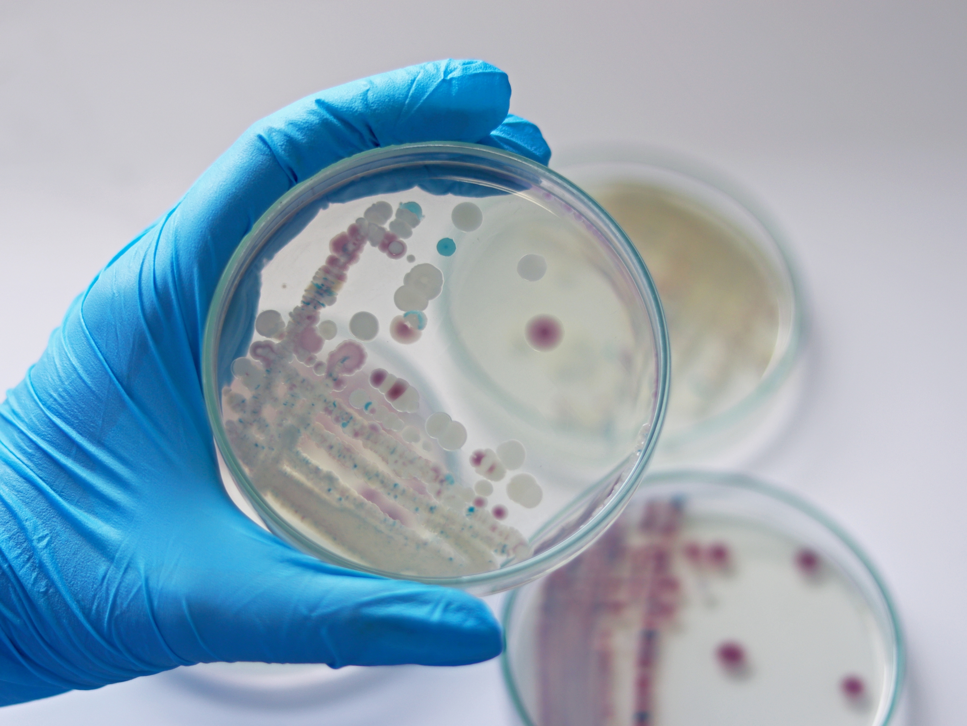 Un investigador sostiene una placa de Petri de 'Vibrio vulnificus'.