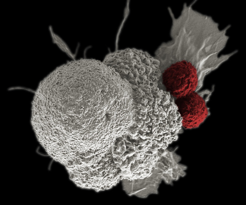 Células T atacan a células tumorales.