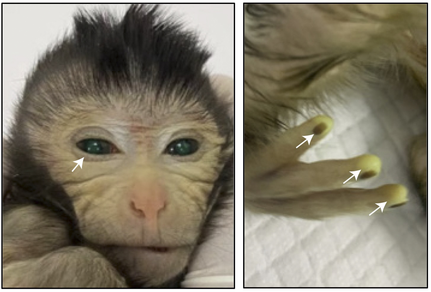 Imágenes que muestran las señales de fluorescencia verde en diferentes partes del cuerpo del mono quimérico nacido vivo a la edad de tres días.