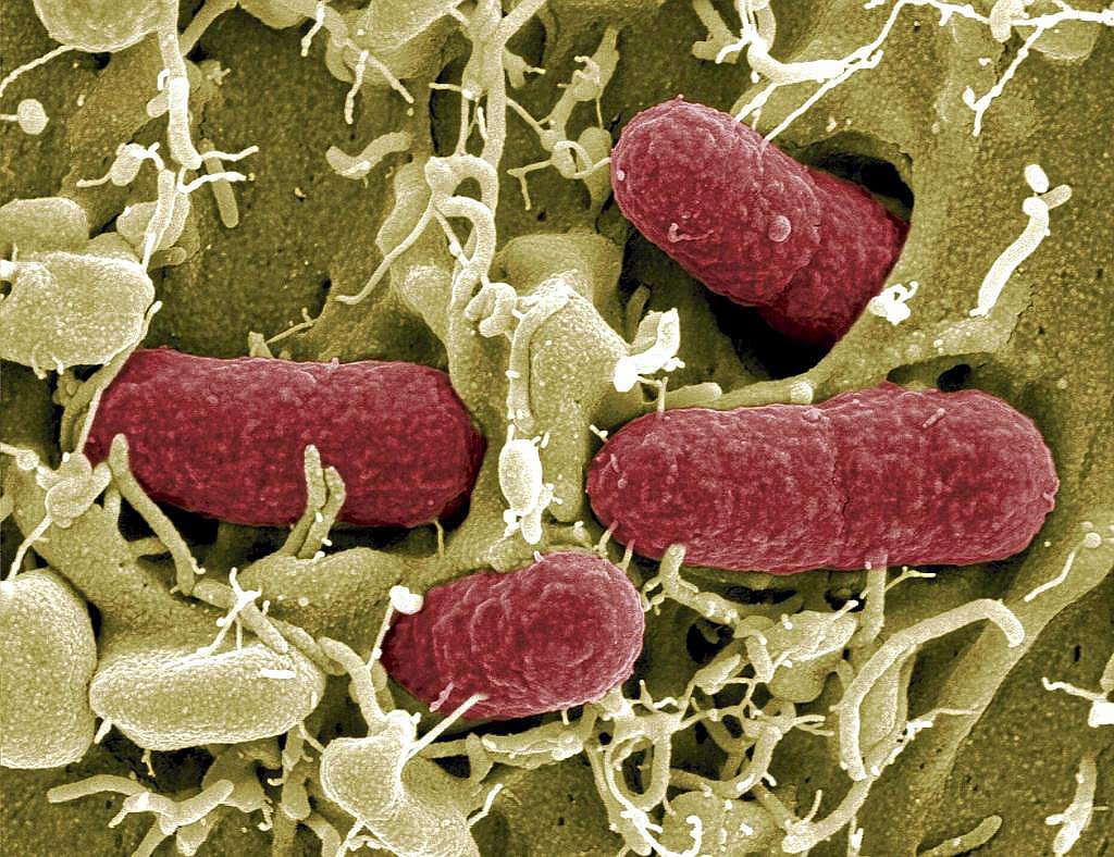 Cepa de la bacteria 'Escherichia coli' resistente a los antibióticos.