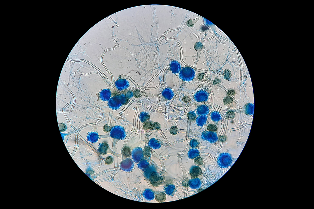 Imagen microscópica de 'Aspergillus fumigatus'.