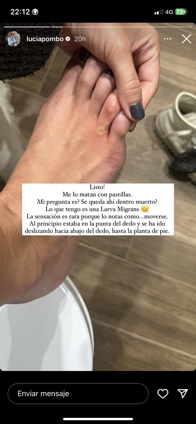 Así mostraba Lucía Pombo el gusano que tenía en el pie en su Instagram