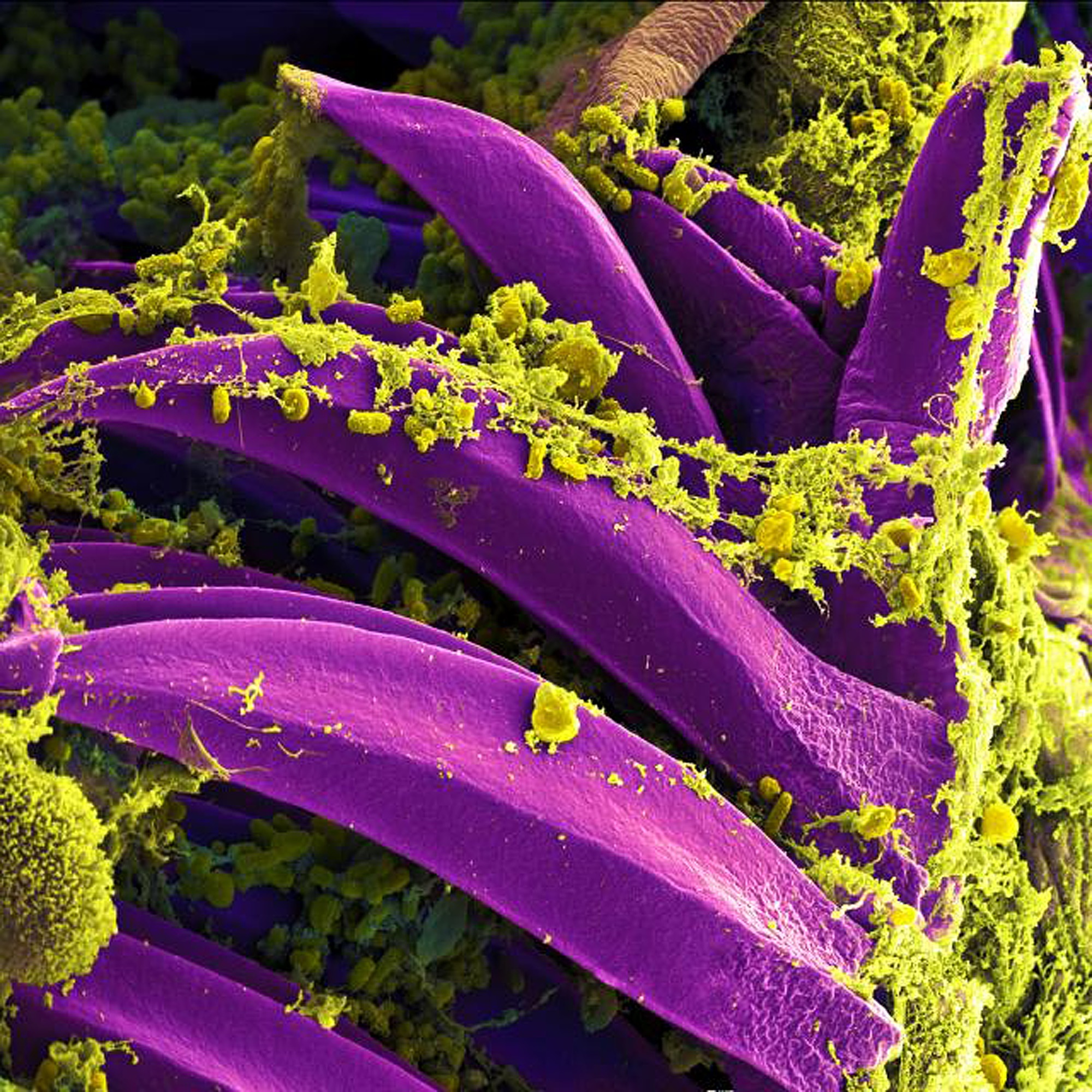 En amarillo, detalle de la bacteria 'Yersinia pestis'.