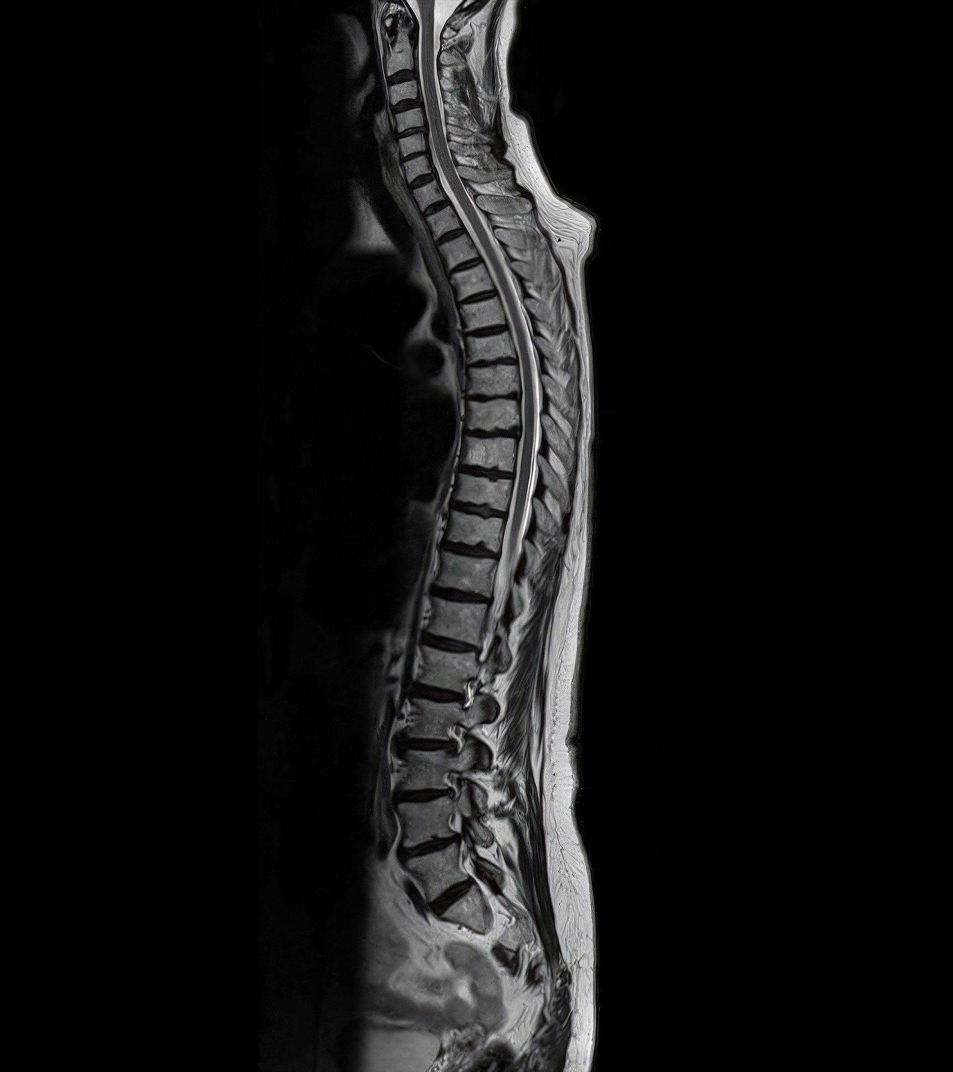 Corte sagital de la espina dorsal completa, obtenida solo en un minuto y 22 segundos.