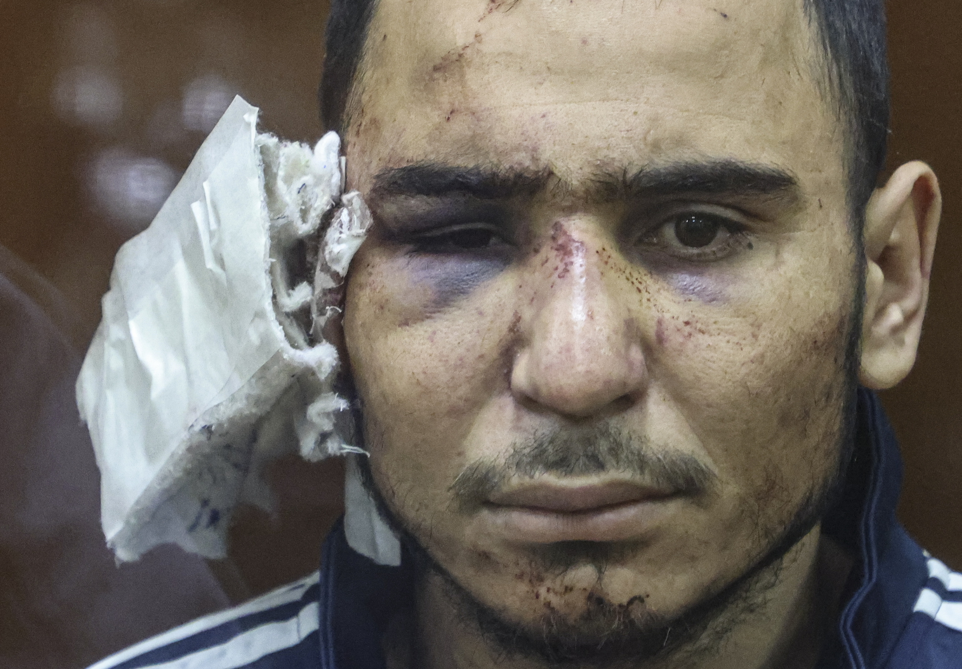 Uno de los detenidos por el atentado en Mosc, con evidentes signos de tortura.