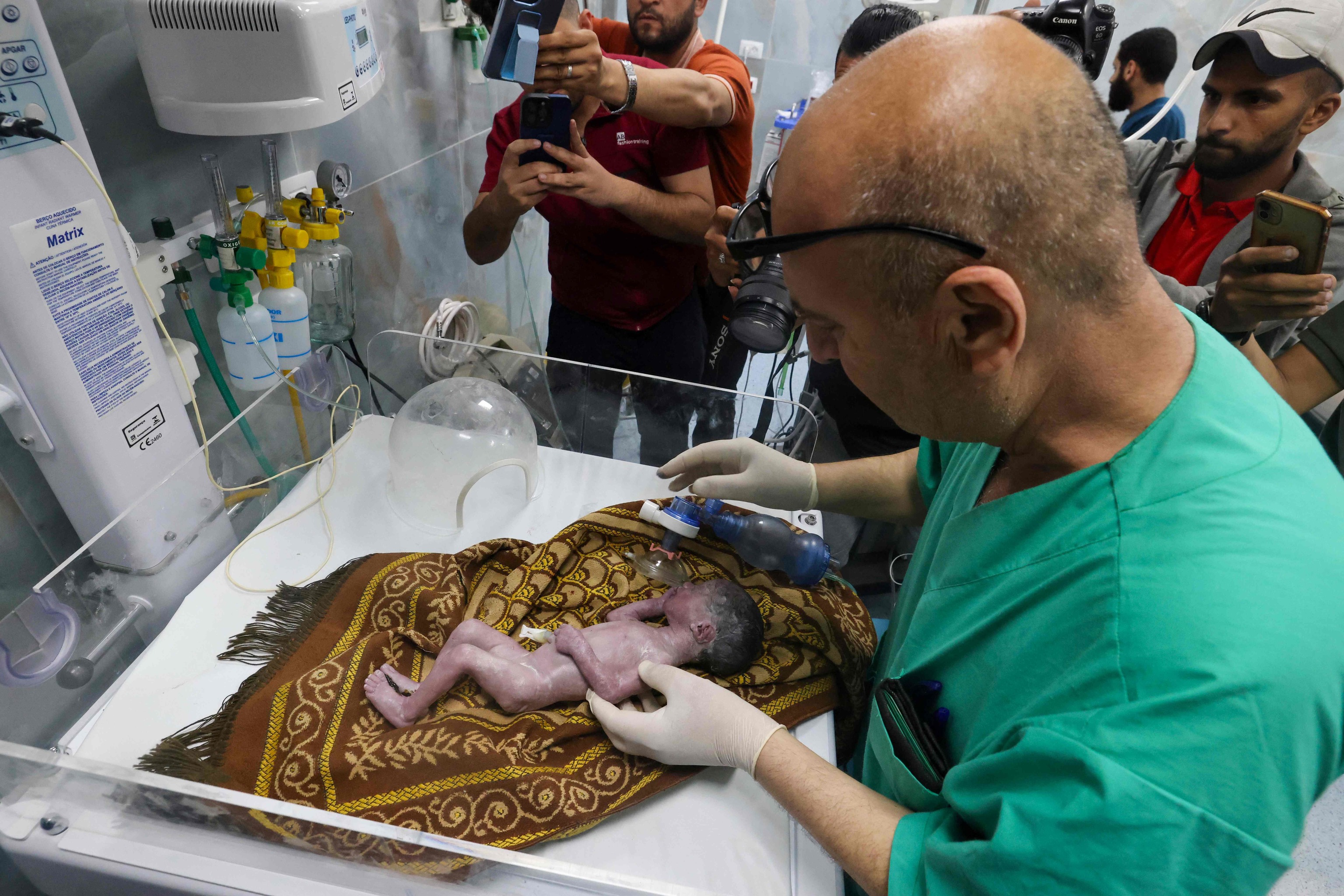 Un mdico atiende a un beb prematuro hijo de una gestante herida en un bombardeo en el hospital Kuwait de Rafah, el sbado