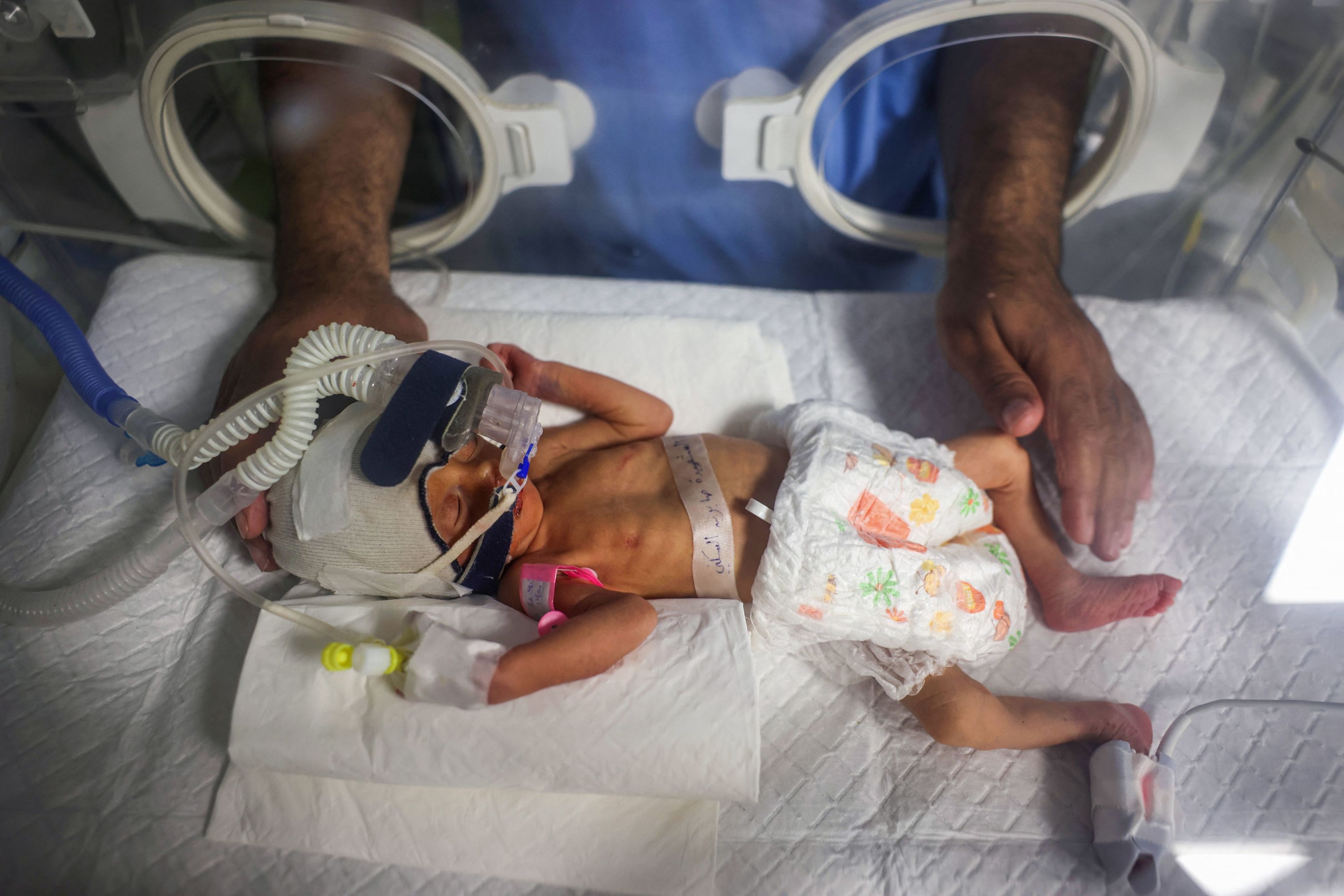 Muere la bebé rescatada por cesárea del vientre de su madre tras un ataque israelí en Gaza