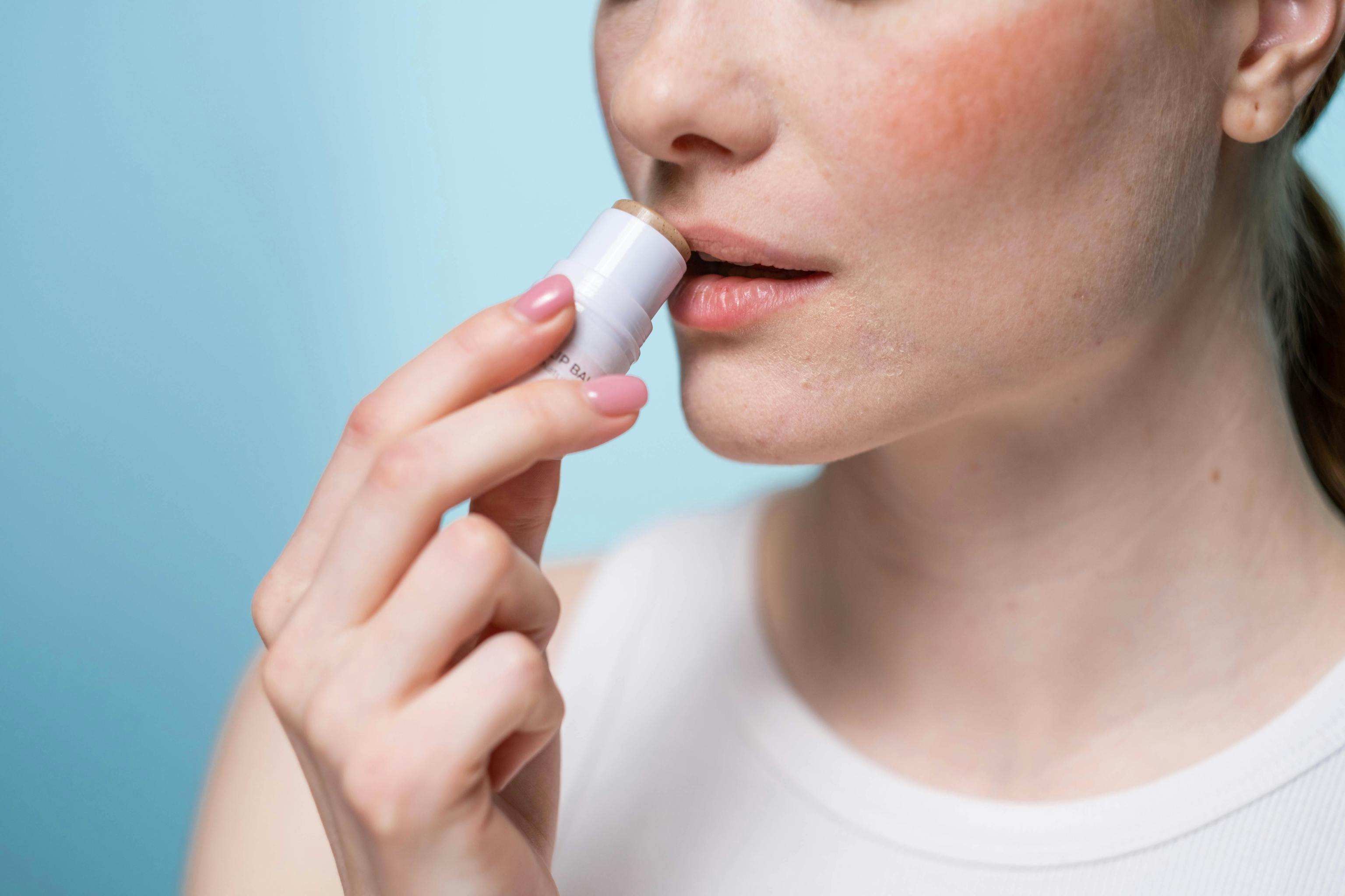 7 bálsamos y cacaos para evitar que tus labios se sequen este verano