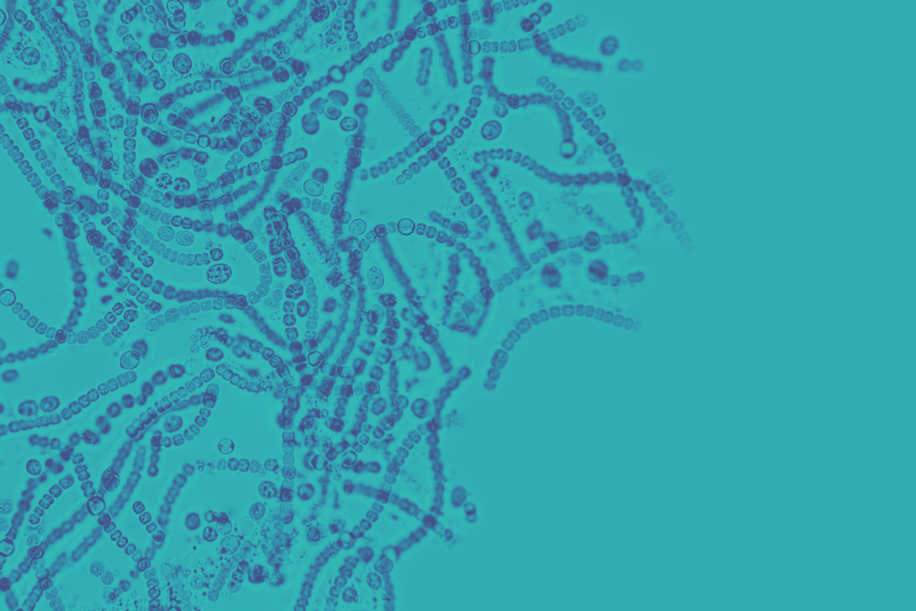 Identifican una 'firma' en los microbios del intestino que se asocia con el cáncer de colon