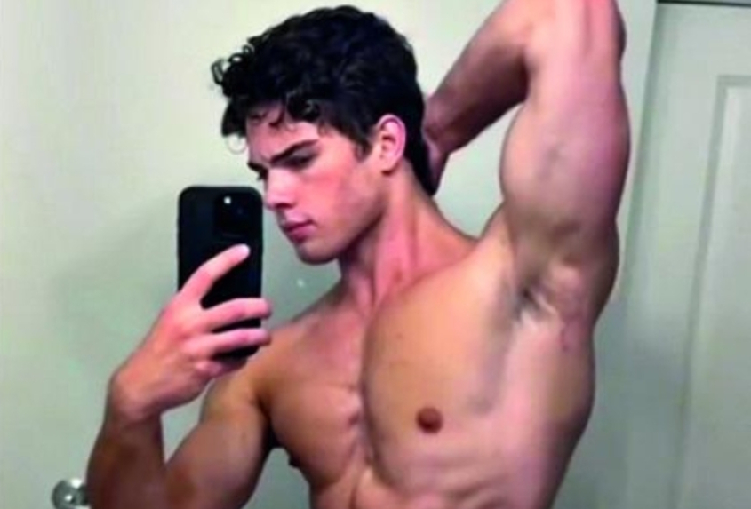La alocada vida de Clavicular: martillos faciales, esteroides, cirugía obsesiva... Así es el 'incel' que quiere convertirse en Superman