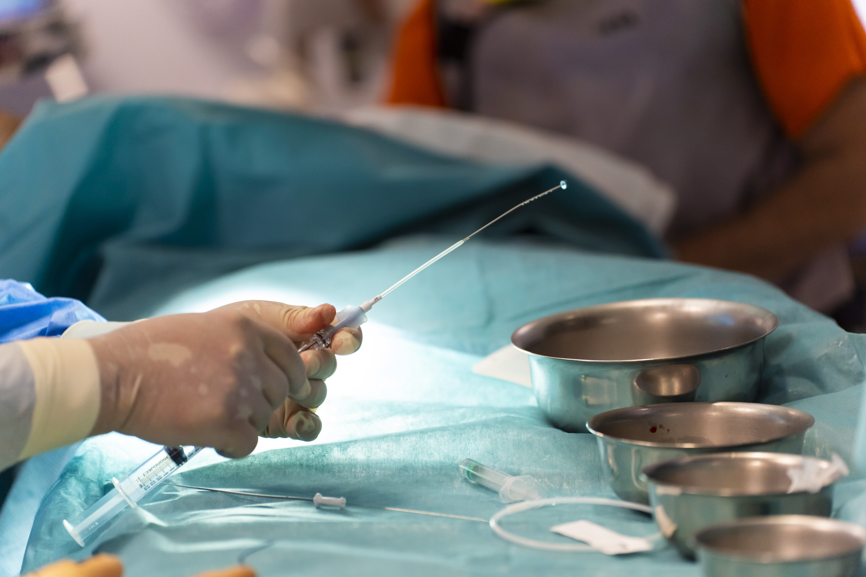 Una ola de especialistas de hospital de diferentes puntos de España dejarán hacer de horas extra para operar a partir del día 1