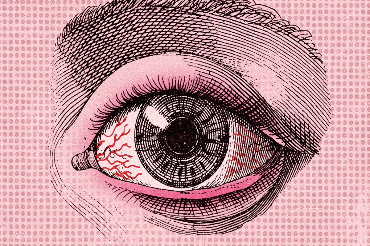 Ni manzanilla, ni otros remedios caseros para afrontar el lagrimeo y picor de ojos síntomas principales de las conjuntivitis