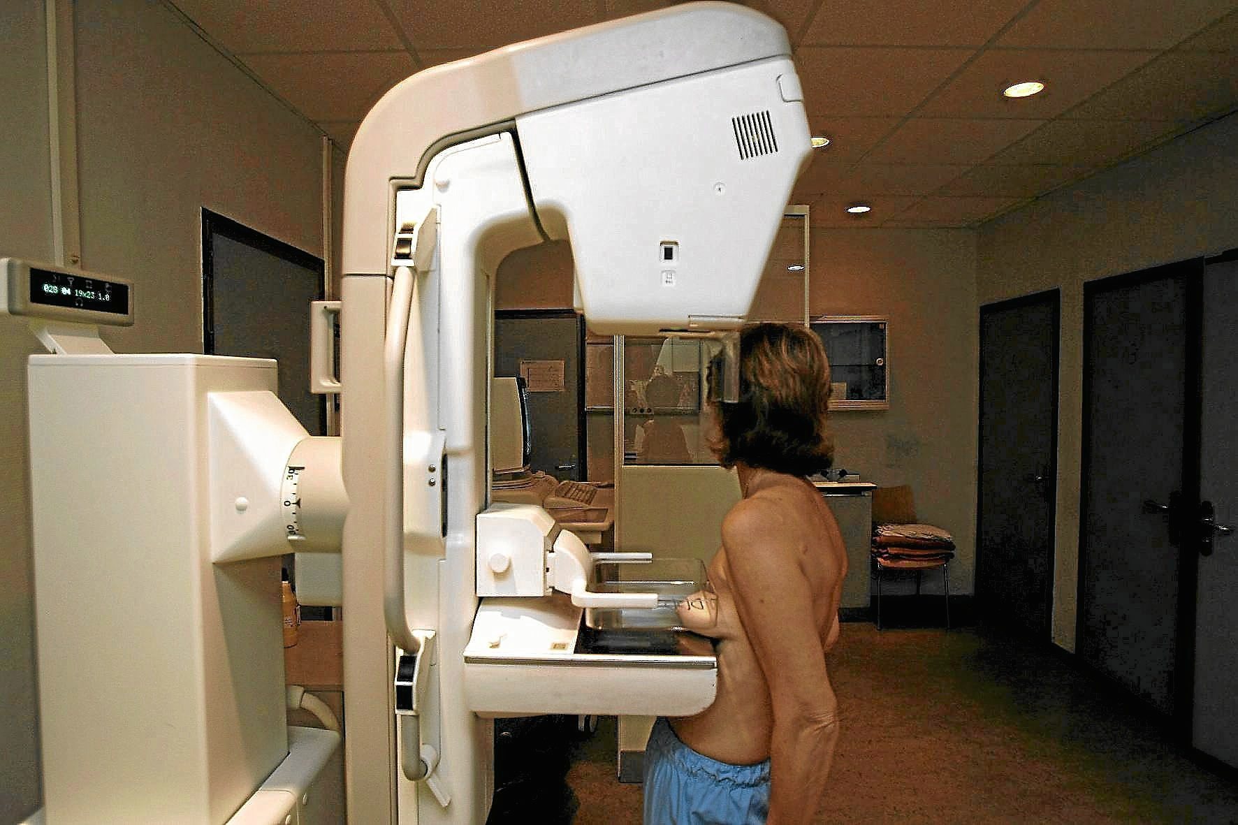 Los fármacos tipo Ozempic abren una nueva vía para prevenir el cáncer de mama