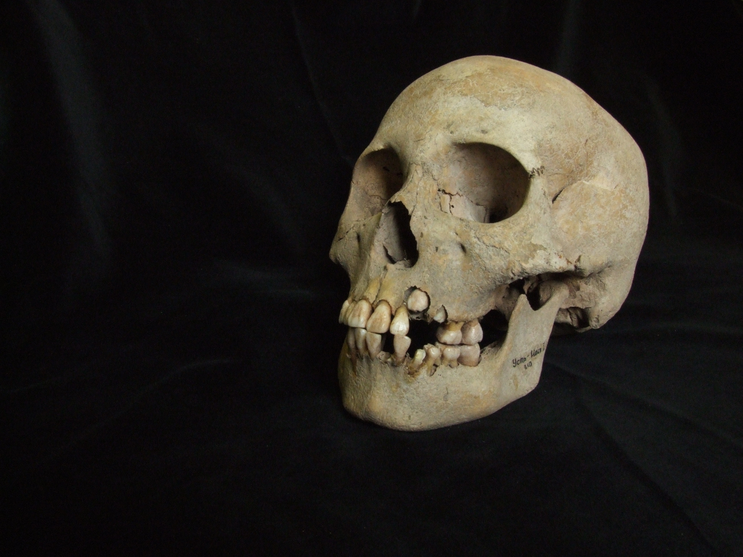 La peste negra ya causaba estragos  hace 5.500 años