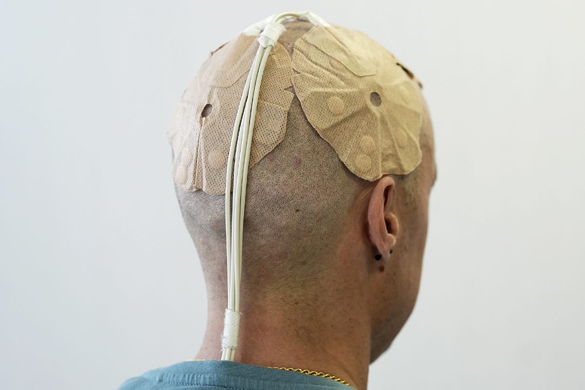 La estrategia experimental que prueba Pablo contra el tumor cerebral más agresivo