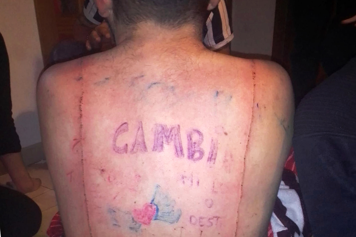 Seis condenados por tatuar un pene en la cara y someter a diversas vejaciones a un joven con discapacidad en Manacor