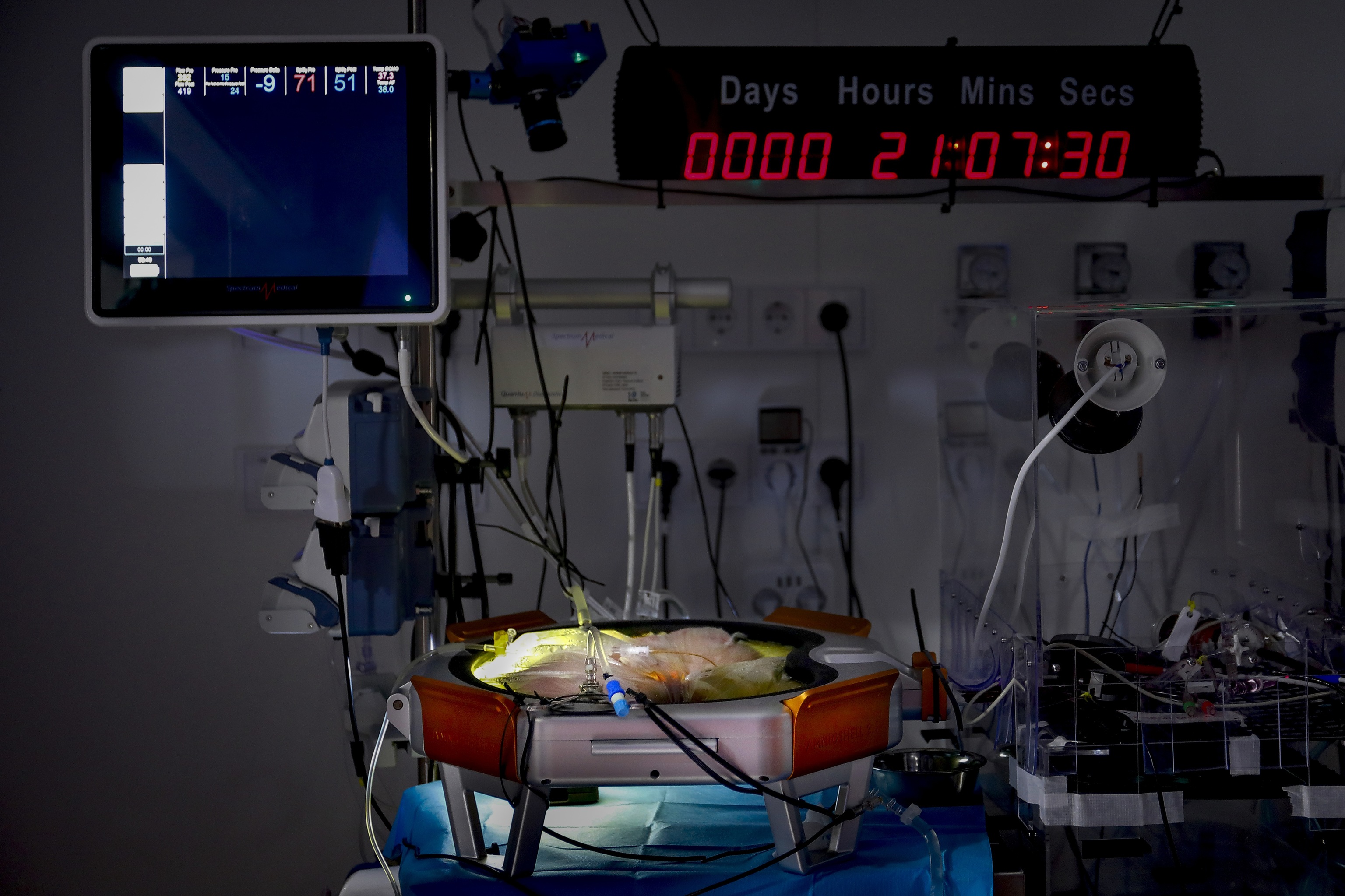 Más cerca de la placenta artificial española para prematuros extremos: el prototipo logra la supervivencia de un feto de oveja durante 21 días
