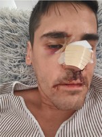 El periodista Fonsi Loaiza denuncia una "brutal agresión": "Lo último que recuerdo es que me llamaron 'rojo, subcampeón' antes de quedar inconsciente"