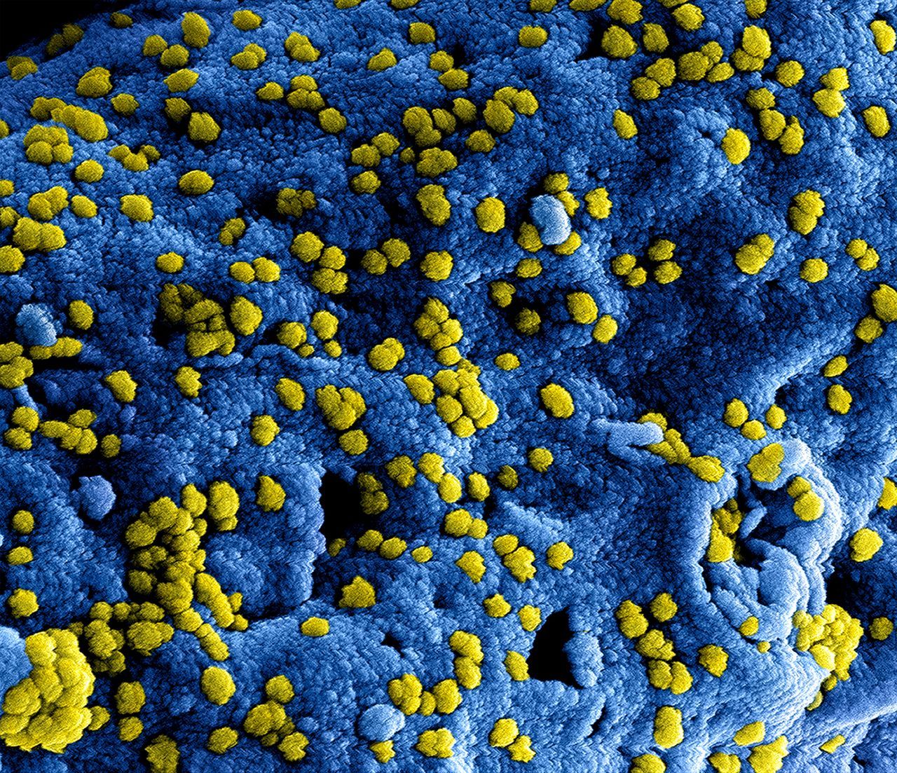 Una IA diseña los primeros virus completos capaces de replicarse en el laboratorio