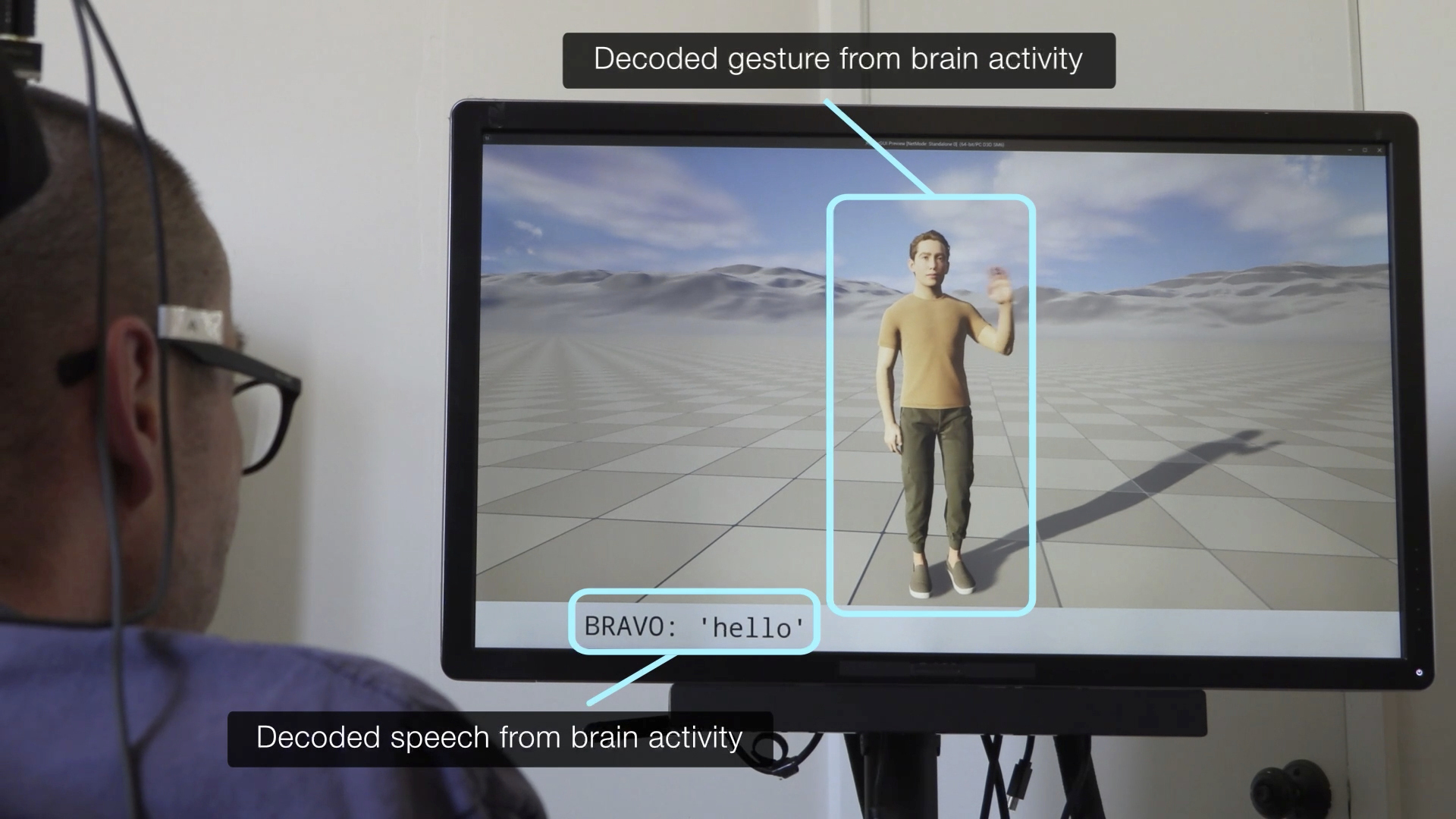 Un implante cerebral logra por primera vez que personas con parálisis no solo hablen, sino que puedan gesticular a través de un avatar