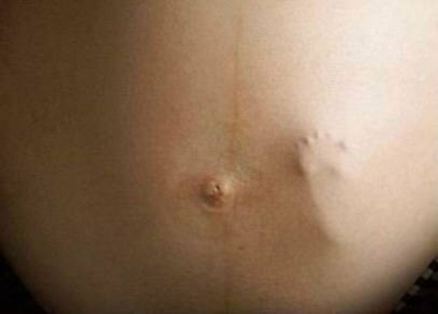 Sinis ironía Típicamente Semana 18: Cuando hacer pis no es una elección | Diario de una embarazada  inexperta | Blogs | elmundo.es
