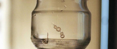 Vista del gusano Anisakis, parásito que aparece en el pescado | Fernando Quintela 