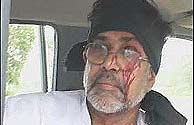 Kailash Satyarthi, director de Marcha Global, tras ser agredido.