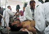 Sanitarios atienden a uno de los iraques heridos en el primer ataque. (Foto: REUTERS)
