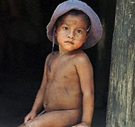 Un nio con desnutricin en su casa de Guatemala. (Foto: AP)